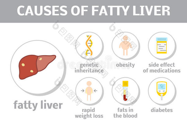 脂肪肝的原因