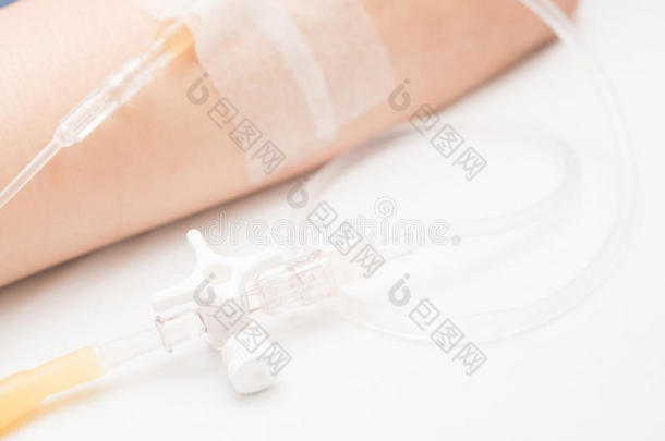 在医院为病人和输液泵关闭生理盐水静脉滴注。