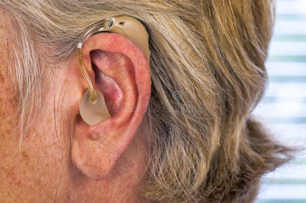 附件成人帮助援助听力学