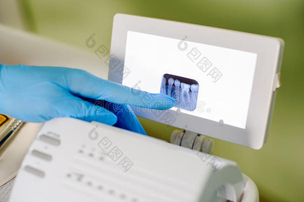 牙科医生在口腔诊所展示x射线