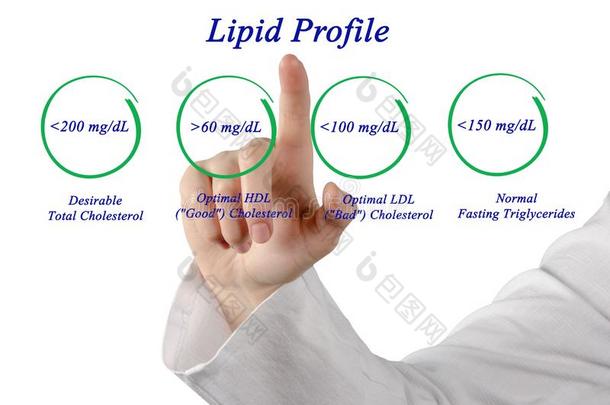 照顾胆固醇概念可取的图表
