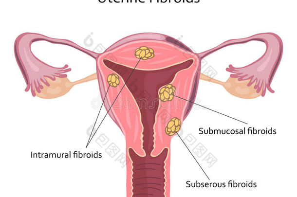 解剖癌症子宫颈的子宫颈周期