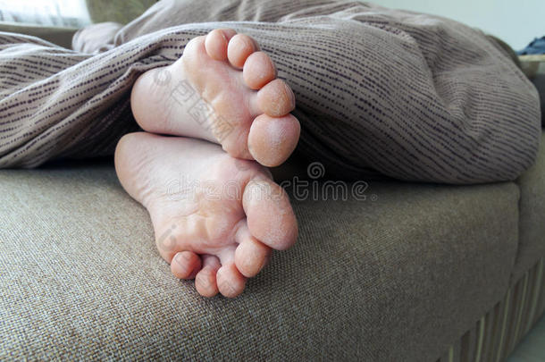 女人脚在床上干裂的皮肤。 足部治疗。