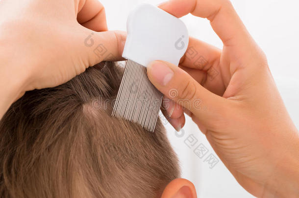 医生治疗男孩`头发