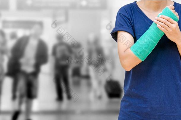 手臂上的事故，受伤的女人手上和手臂上有绿色的石膏