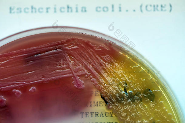 大肠杆菌菌落在Macconkey琼脂平板上进行试验。 集中注意力