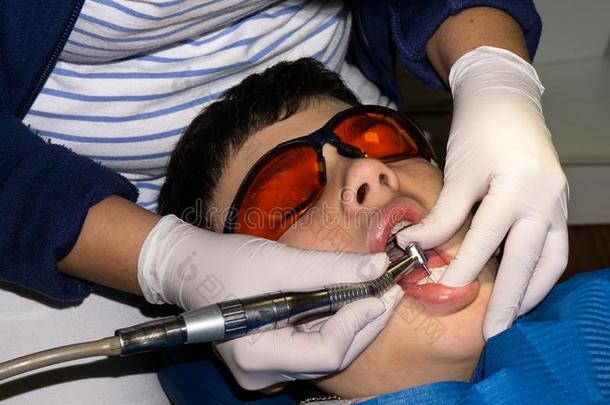 <strong>自闭</strong>症男孩在牙科治疗中。 支撑。 保健