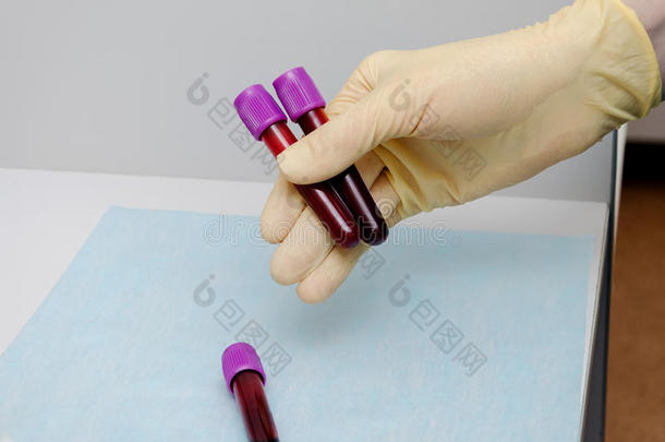 手持试管，血浆准备测试