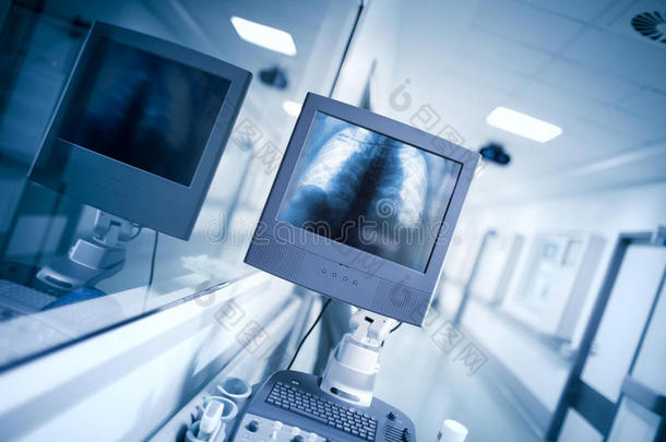 医院大厅的检查设备有X光图像