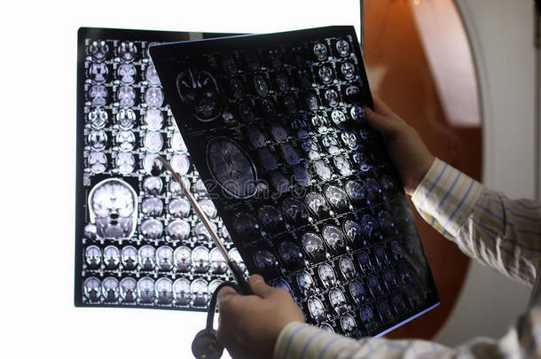 医生拿着一张脑MRI工作流程的照片