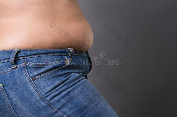 腹部脂肪肥胖坏的大的
