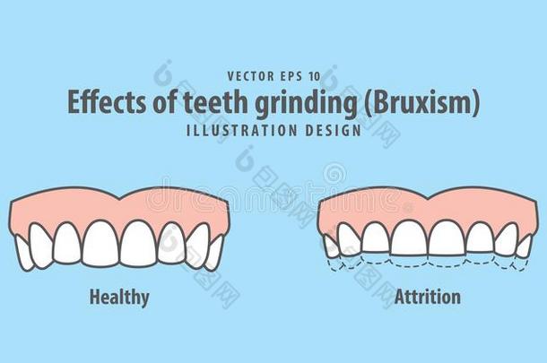 动产关于牙磨的夜<strong>磨牙</strong>症说明矢量向蓝色