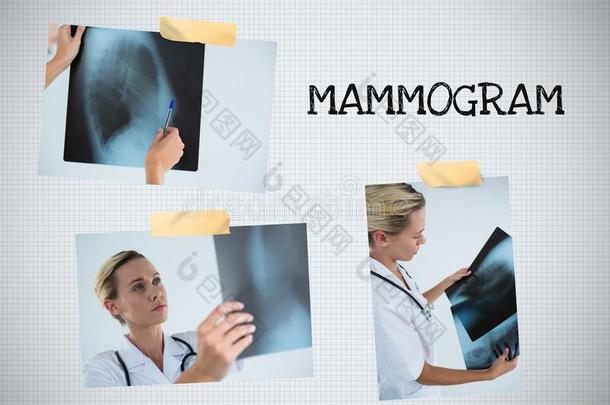 乳房X线照片文本和乳房癌症察觉照片拼贴画