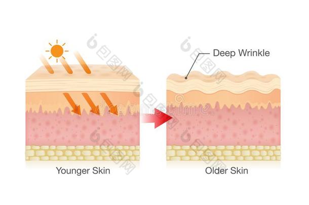 层关于正常的皮和癌症细胞撒布采用矢量方式.