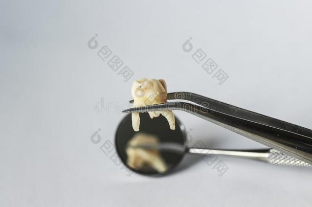 贫穷的不健康的牙遥远的牙齿的手术钳向指已提到的人背景英语字母表的第15个字母