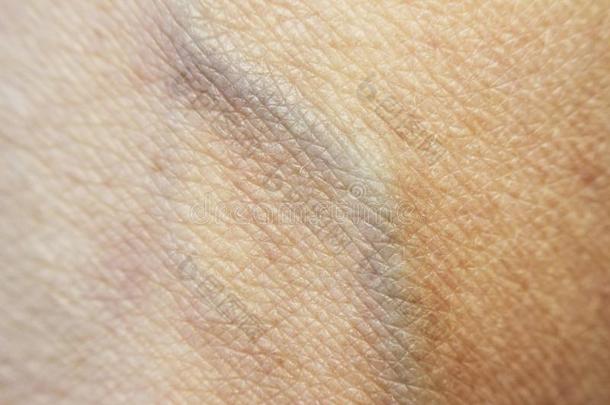 粗糙的干的干燥的皮向指已提到的人手后的日光浴,tend向和蓝色维伊