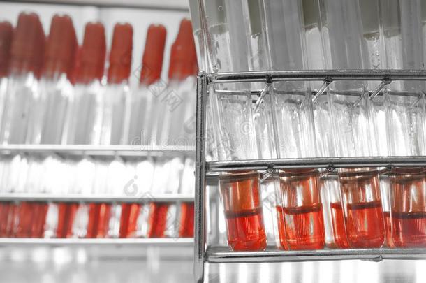 血测试采用实验室