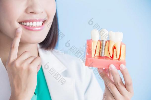 女人牙科医生拿移植物牙