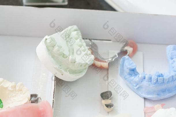 牙齿的样品仪器采用牙齿的cl采用ic