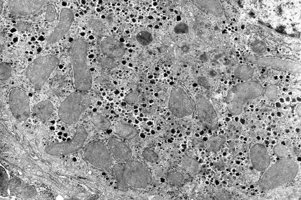 细胞质.细胞细胞器,transmissionelectronmicroscope透射电子显微镜