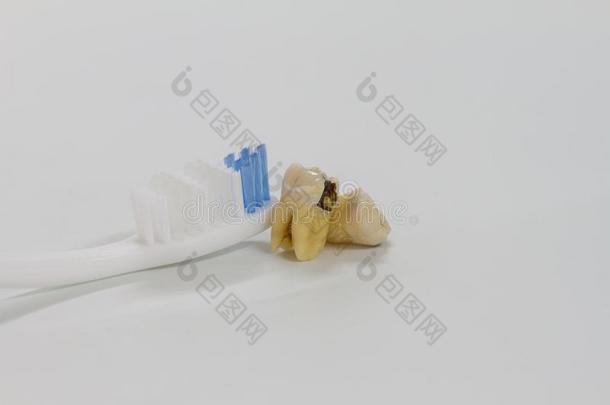 牙腐烂牙齿的龋齿和牙刷子