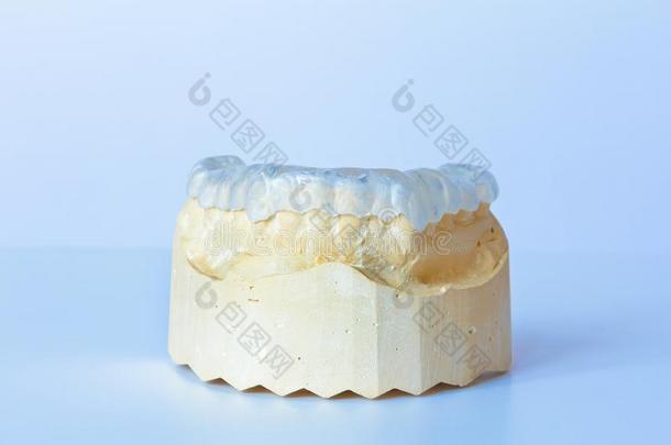 塑料制品牙警卫牙齿的铸模