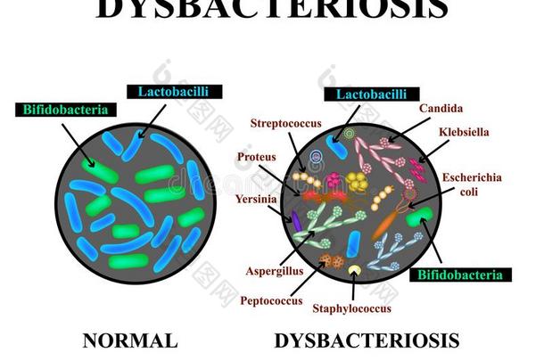 菌落<strong>失调</strong>症肠.乳酸菌,双歧杆菌,Strepto