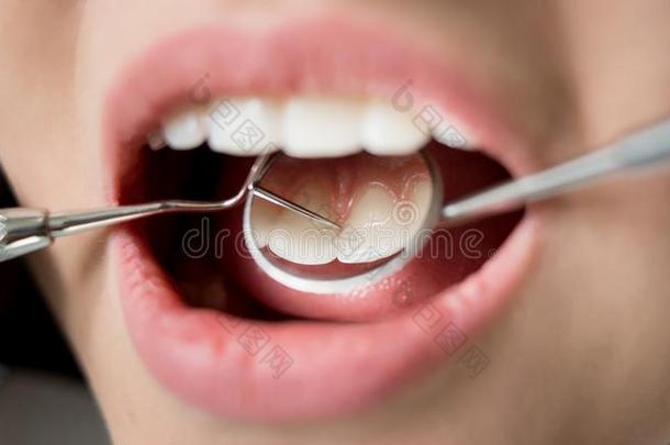 宏指令射手关于年幼的女人所有牙齿的检查在上面采用牙齿的cl采用i