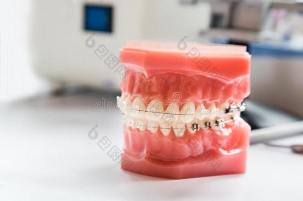 正牙学牙齿的吊带向牙模型向使成一线牙