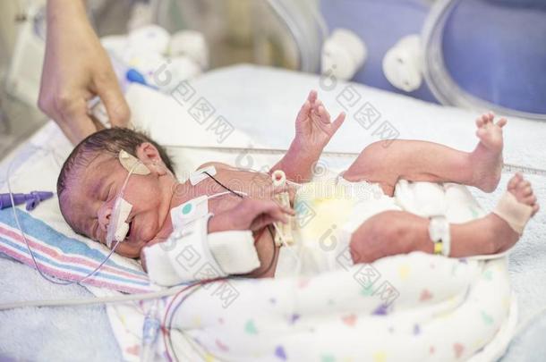 新生的过早的婴儿采用指已提到的人新生儿加强监护病房采用tensive关心
