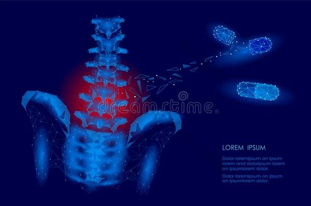 人脊柱臀部<strong>腰部</strong>的脊神经根炎痛苦低的工艺学校.几何学的工艺学校