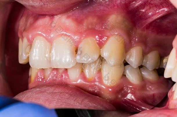教学的举例关于牙齿的问题