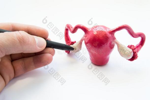 医生或教师道岔关于圆珠笔笔向卵巢向解剖的