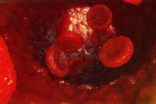 3英语字母表中的第四个字母说明红色的血细胞采用ve采用.红色的血细胞流采用