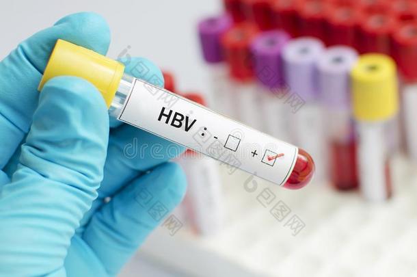 肝炎英语字母表的第2个字母病毒积极的