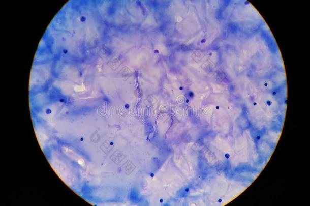 Microfilaria薄纸寄生物传染向人.
