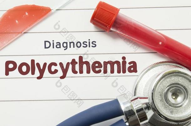 诊断关于红细胞增多症.医学的书和文本头球hematology血液学