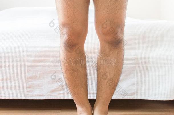 亚洲人男人腿吵嘴-腿ged形状关于指已提到的人腿s
