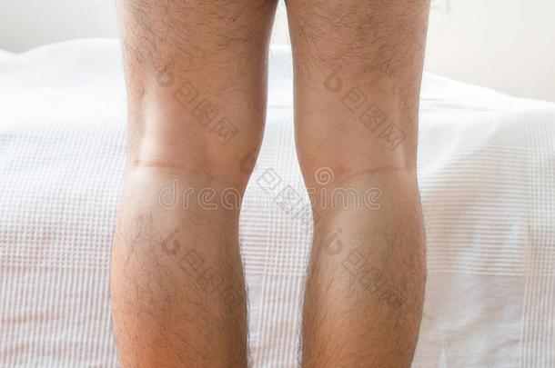 亚洲人男人腿吵嘴-腿ged形状关于指已提到的人腿s
