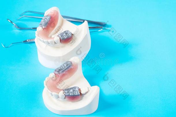 牙科医生工具和<strong>口腔修复</strong>学模型.