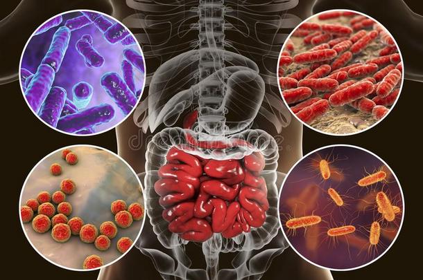 肠的微生物组<strong>防治</strong>微生物感染的生态学方法,细菌开拓殖民地小的肠