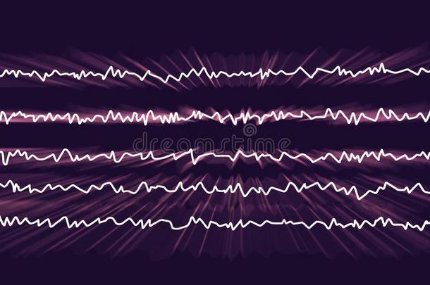 electroencephalograp脑电图描记器脑电波,脑波浪采用醒着的国家和内心的