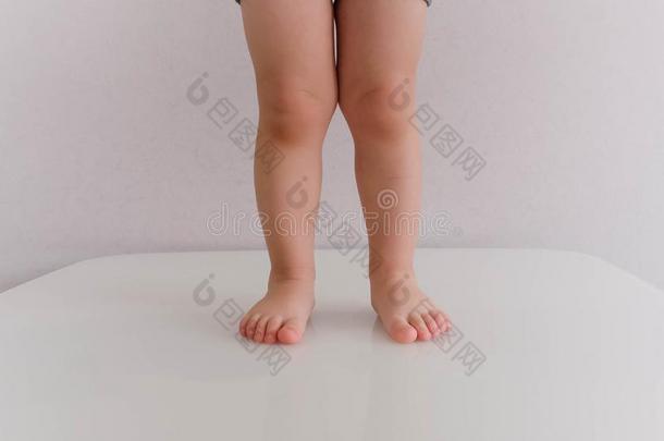 低的部分关于婴儿男孩起立.2年老的平的脚采用一希腊字母的第22字