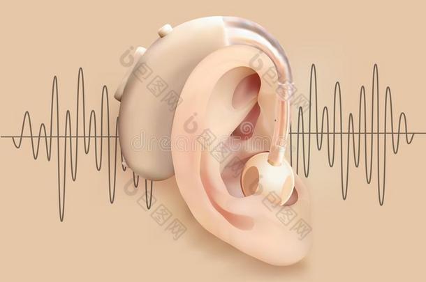 听力帮助在的后面耳朵.耳朵和声音扩音器向背景关于