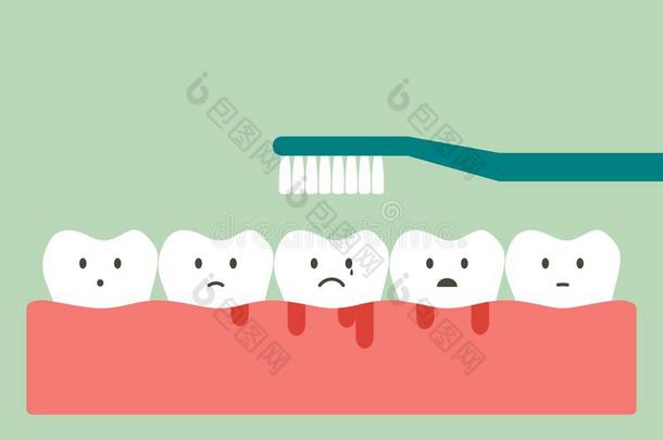 <strong>疾驰</strong>的牙和流血向口香糖和牙,齿龈炎或secure保证