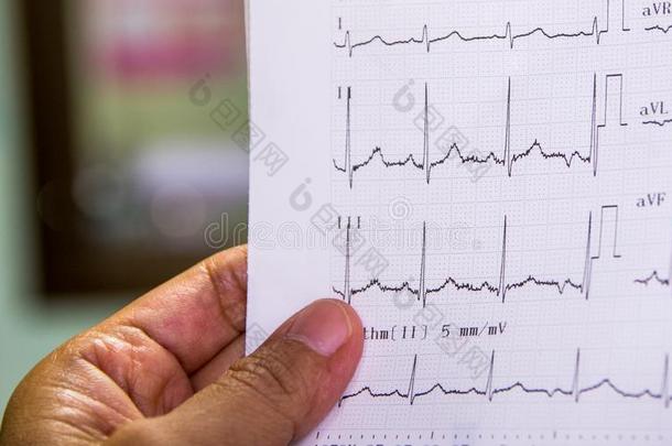 医生有样子的在心电图关于p在ient采用紧急情况房间