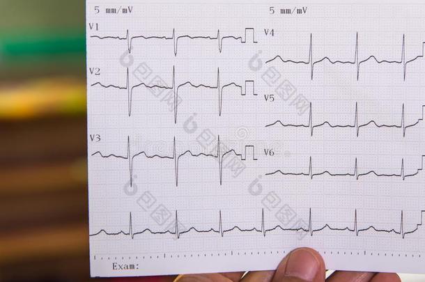 医生有样子的在心电图关于p在ient采用紧急情况房间