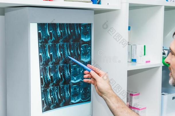 关在上面医生手弄尖在字母x-射线影像关于颈的脊柱.
