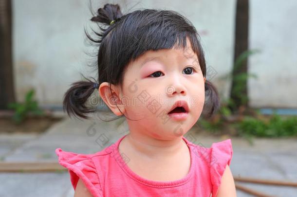 亚洲人婴儿女孩眼睛增强