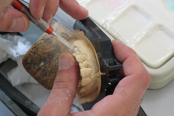牙齿的实验室设备和处理
